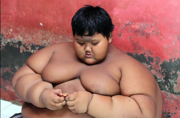 Arya era considerado o menino mais gordo do mundo (Foto: Reprodução/The Sun)