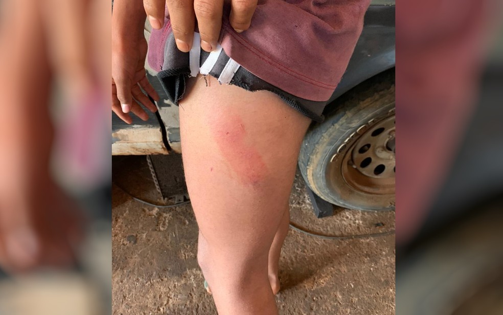 Adolescente enviou carta contando a vizinhos que era agredido pelo pai por ser gay: 'Não aguento mais'