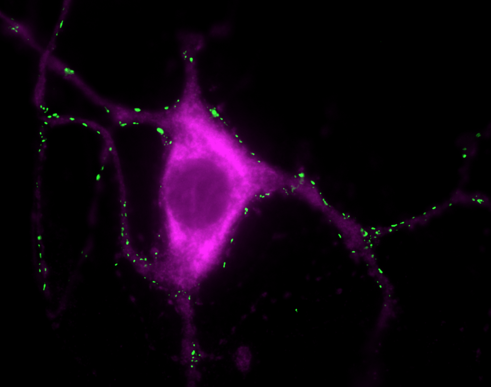 Marcador de sinapse em neurônio. — Foto: Janin Lautenschläger