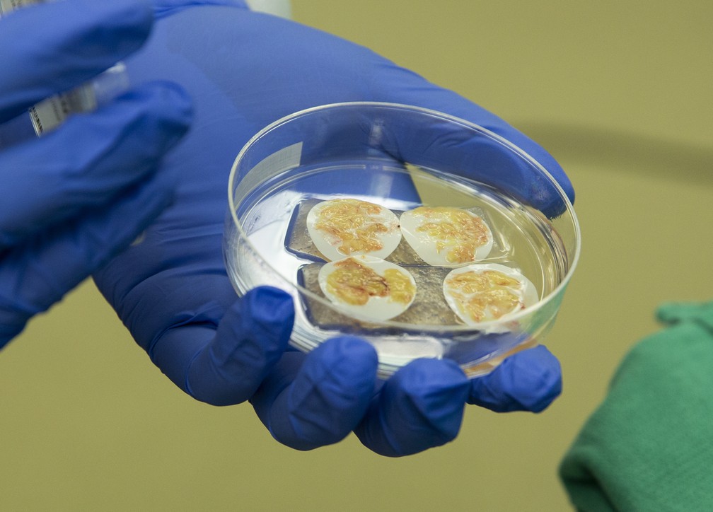Foto mostra tecido do timo para transplante em um bebê em 16 de agosto de 2021 no hospital da Universidade Duke, no estado americano da Carolina do Norte. — Foto: Shawn Rocco/Duke Health via AP