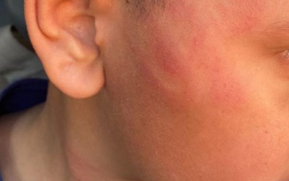 Mãe é presa suspeita de espancar filho de 8 anos com pedaço de pau e chineladas no rosto, em Anápolis