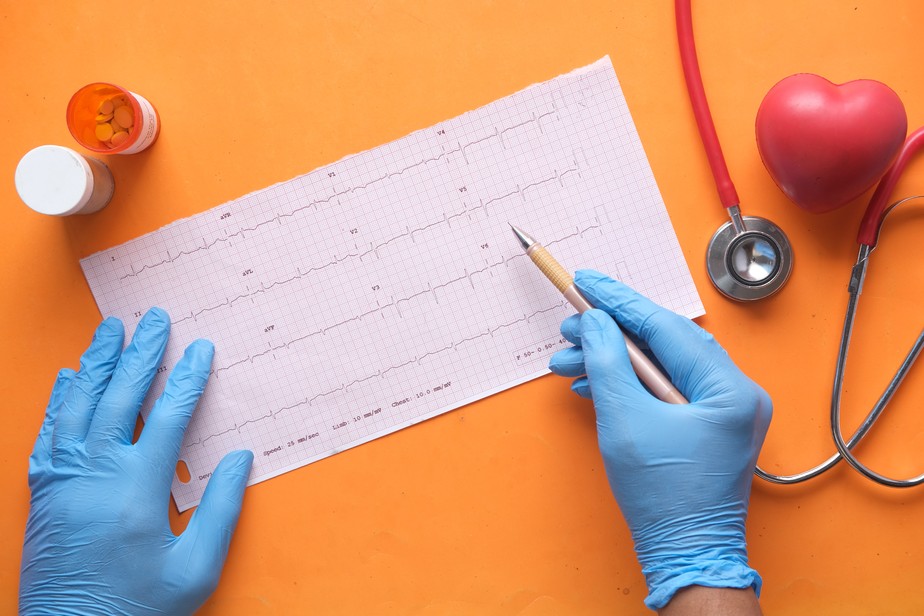 Insuficiência cardíaca: 10% dos pacientes internados morrem no Brasil, mostra estudo