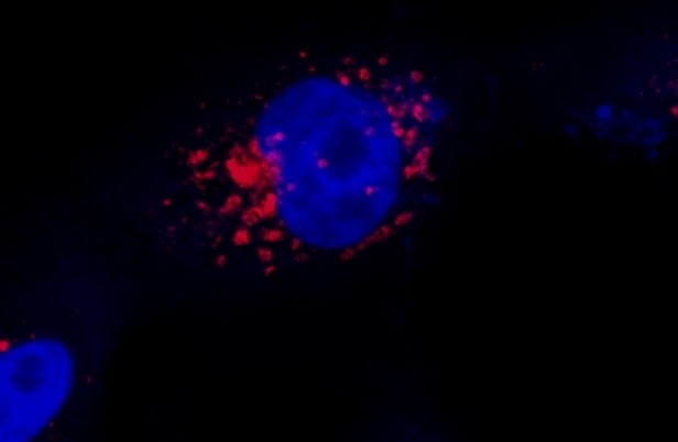 Protocolo desenvolvido por pesquisadores da Unicamp mostra Sars-CoV-2 se replicando na periferia do núcleo celular (Foto: Luana Nunes Santos/Unicamp)