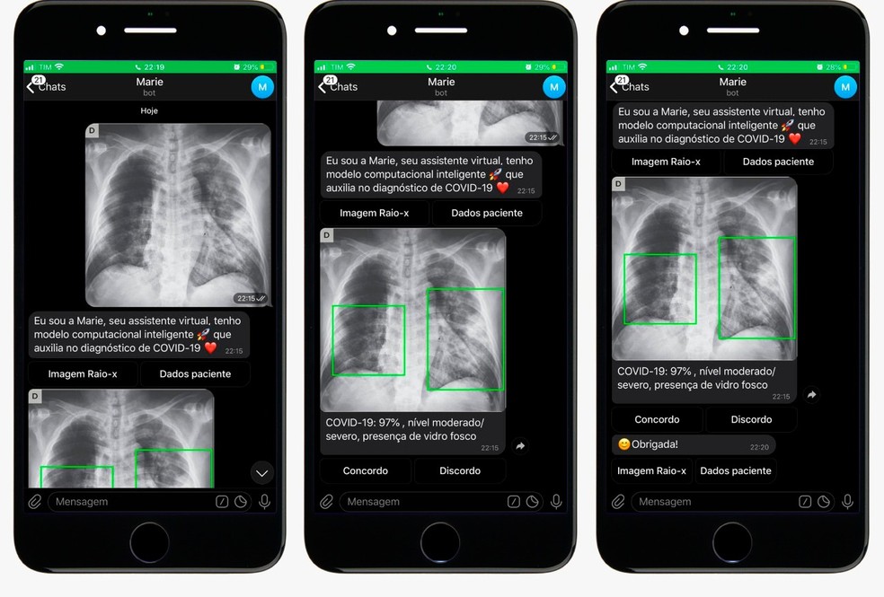 Grupo Desenvolve Aplicativo Que Identifica Covid 19 A Partir De Raio X Do Pulmao Ribeirao Preto E Franca G1
