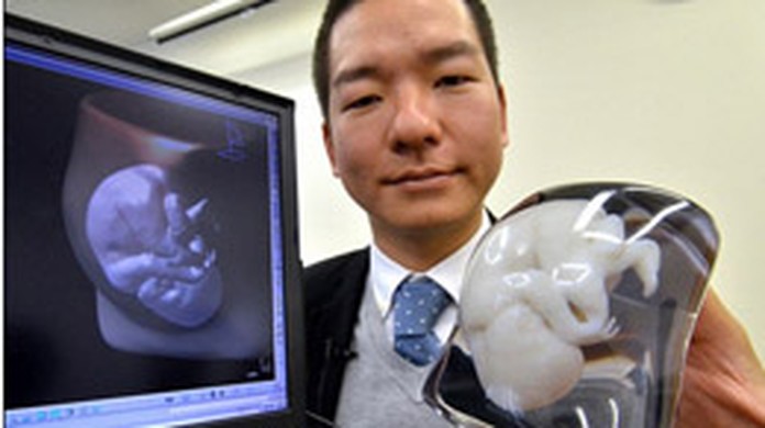 Japoneses Criam Prototipo 3d Do Feto Antes De O Bebe Nascer Maes E Filhos Gnt