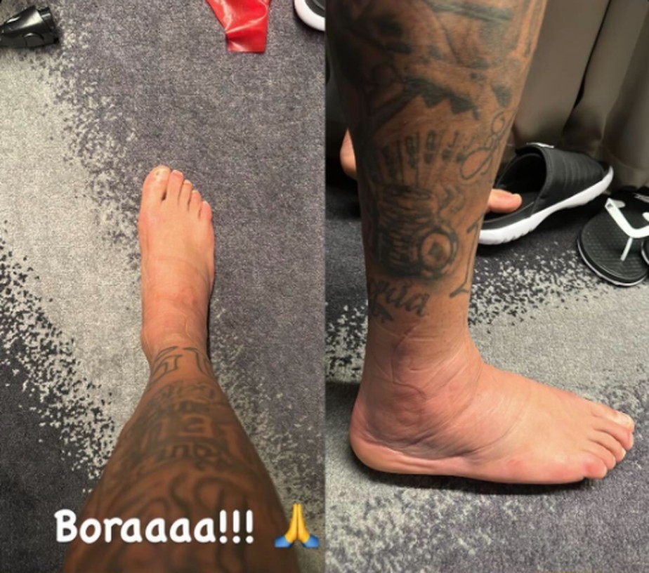 Neymar posta foto do pé após lesão