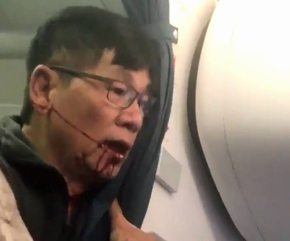 David Dao ensanguentado após ser arrancado do avião e conseguir retornar (Foto: Reprodução/Twitter/Kaylyn Davis)