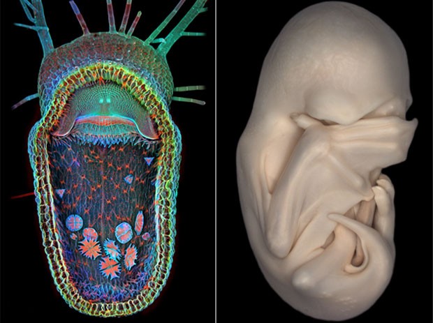 À esquerda, a imagem de uma planta carnívora (Utricularia gibba) bocejando; à direita, um embrião de morcego (Foto: Divulgação/Igor Siwanowicz/Dorit Hockman/2013 Olympus BioScapes Digital Imaging Competition)