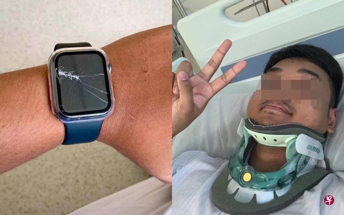 Apple Watch chama socorro para motociclista atropelado por van