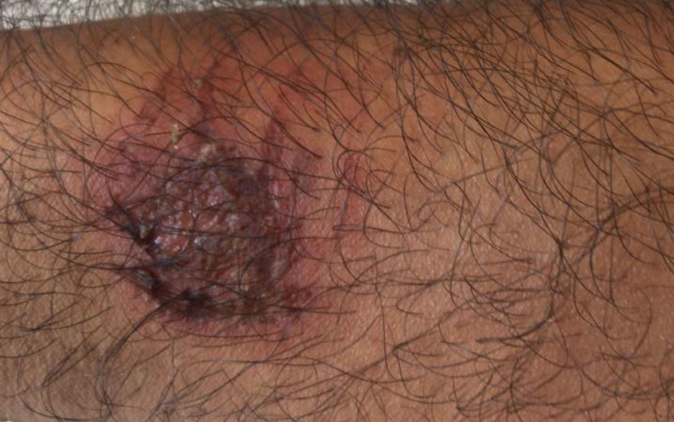 Motorista de aplicativo relata assédio e agressão após corrida durante carnaval — Foto: Arquivo pessoal