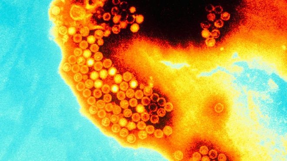 Resultado de imagem para hepatite a