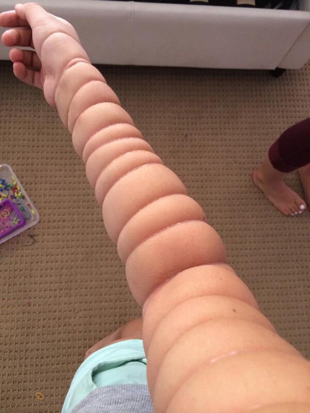 Jovem virou hit ao transformar seu braço em uma 'minhoca' (Foto: Reprodução/Twitter/gigiilee)