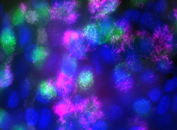 Imagem de imunofluorescência mostra os cílios pulmonares (rosa), o núcleo da célula pulmonar (azul) e partículas de vírus (verde) (Foto: Grace Roberts/Cedido pela autora)