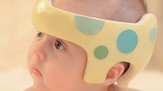 Assimetria craniana nos bebês: entenda as causas e conheça as opções de tratamentos