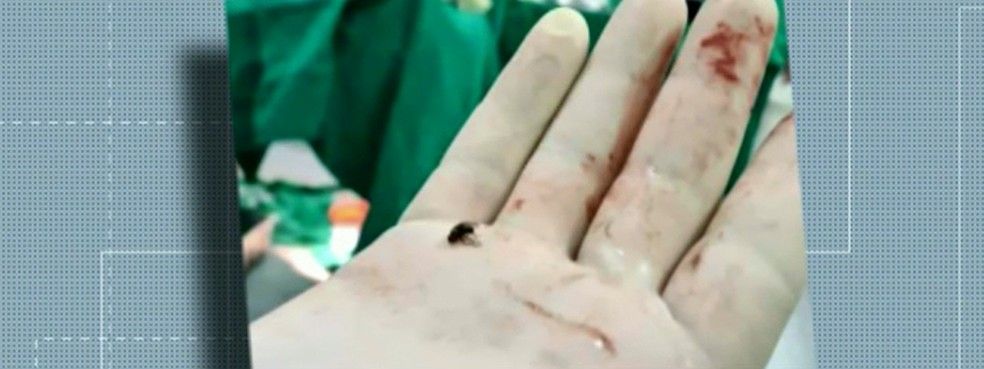 Imagens recebidas pelo MP mostram mosca morta em centro cirúrgico do hospital  — Foto: Reprodução RPC