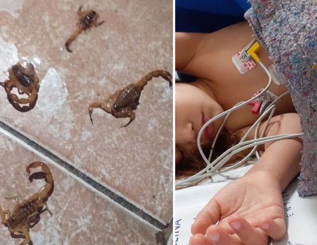 Menino ficou em estado grave após picada de escorpião (Foto: Reprodução Facebook)