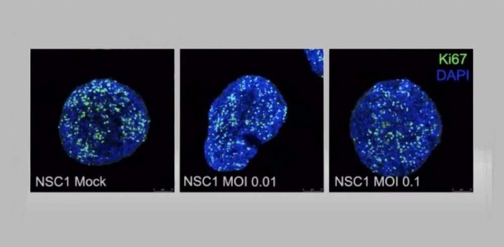 Experimentos realizados em células nervosas por pesquisadores do Instituto D’Or e da UFRJ (Foto: Reprodução)