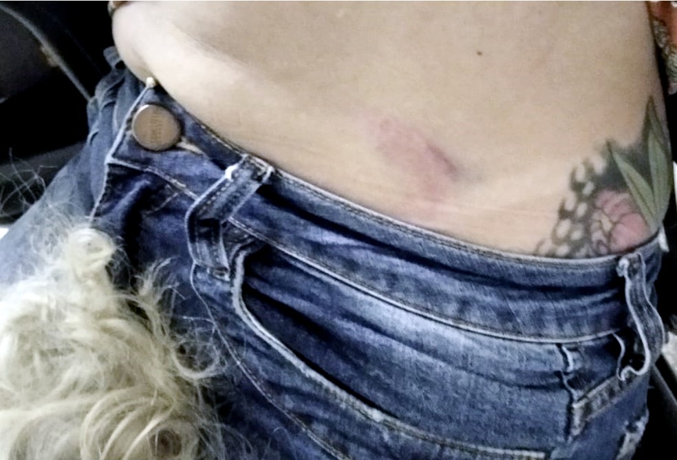 Mulher disse que foi agredida pelo companheiro com socos e pauladas — Foto: Polícia Militar