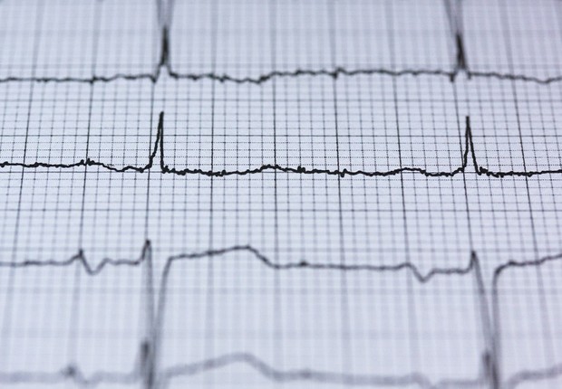 saúde, eletrocardiograma (Foto: Pexels)