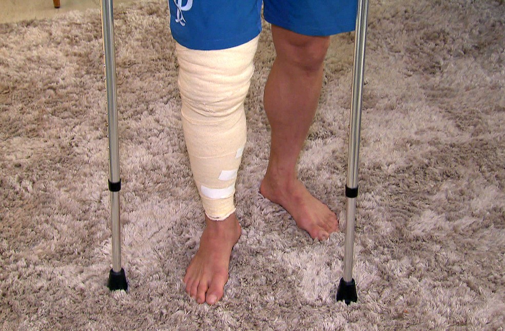 Willian, atacante do Palmeiras, com a perna enfaixada â€” Foto: ReproduÃ§Ã£o/TV Globo