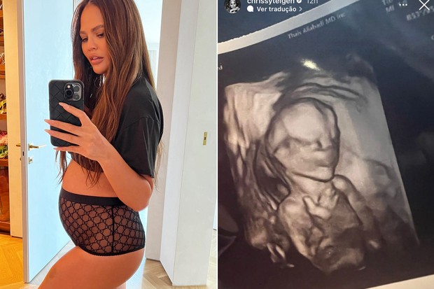 Chrissy Teigen anunciou recentemente que espera novo bebê com John Legend (Foto: Reprodução / Instagram)