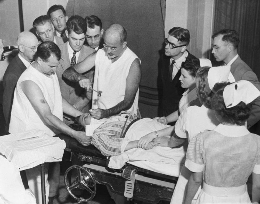 Walter Freeman demonstrando sua técnica de lobotomia transorbital em 1949 — Foto: Getty Imagens via BBC