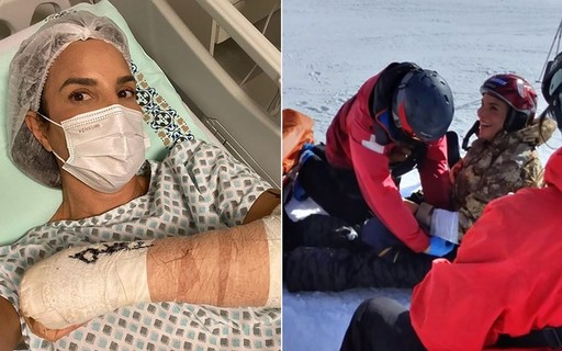 Ivete Sangalo posta vídeo de acidente esquiando: "Quebrei o punho. Dor insuportável"