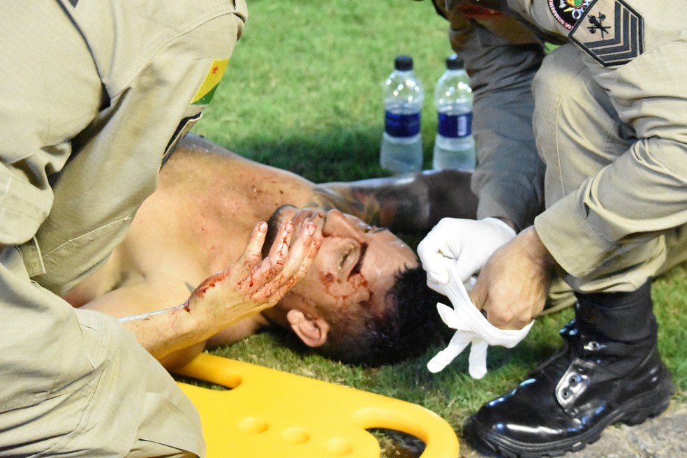 Mandim sofreu corte profundo na cabeça ao se chocar contra joelho de companheiro no clássico diante do Rio Branco-AC — Foto: Manoel Façanha/Arquivo Pessoal