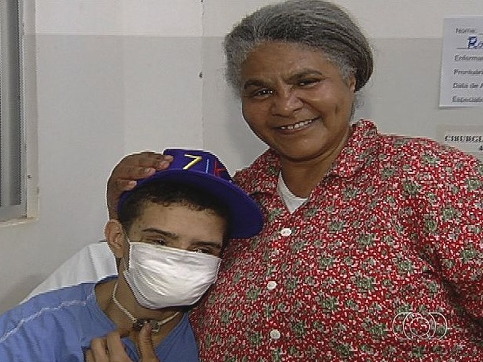 Samuel na época que fez a cirurgia de reconstrução facial, em Goiânia, Goiás — Foto: Reprodução/TV Anhanguera