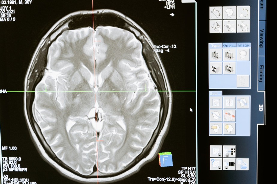 Cientistas detectaram aumento de atividade no cérebro de duas pessoas em transição para a morte