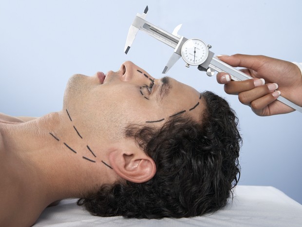 Cosmetic surgery. Vernier calipers being used by a surgeon to measure the length of the nose of a patient about to have cosmetic surgery. A common cosmetic surgery procedure is to shorten the length of a patient's nose. The marks on the patient's face sho (Foto: Getty Images/Science Photo Libra)