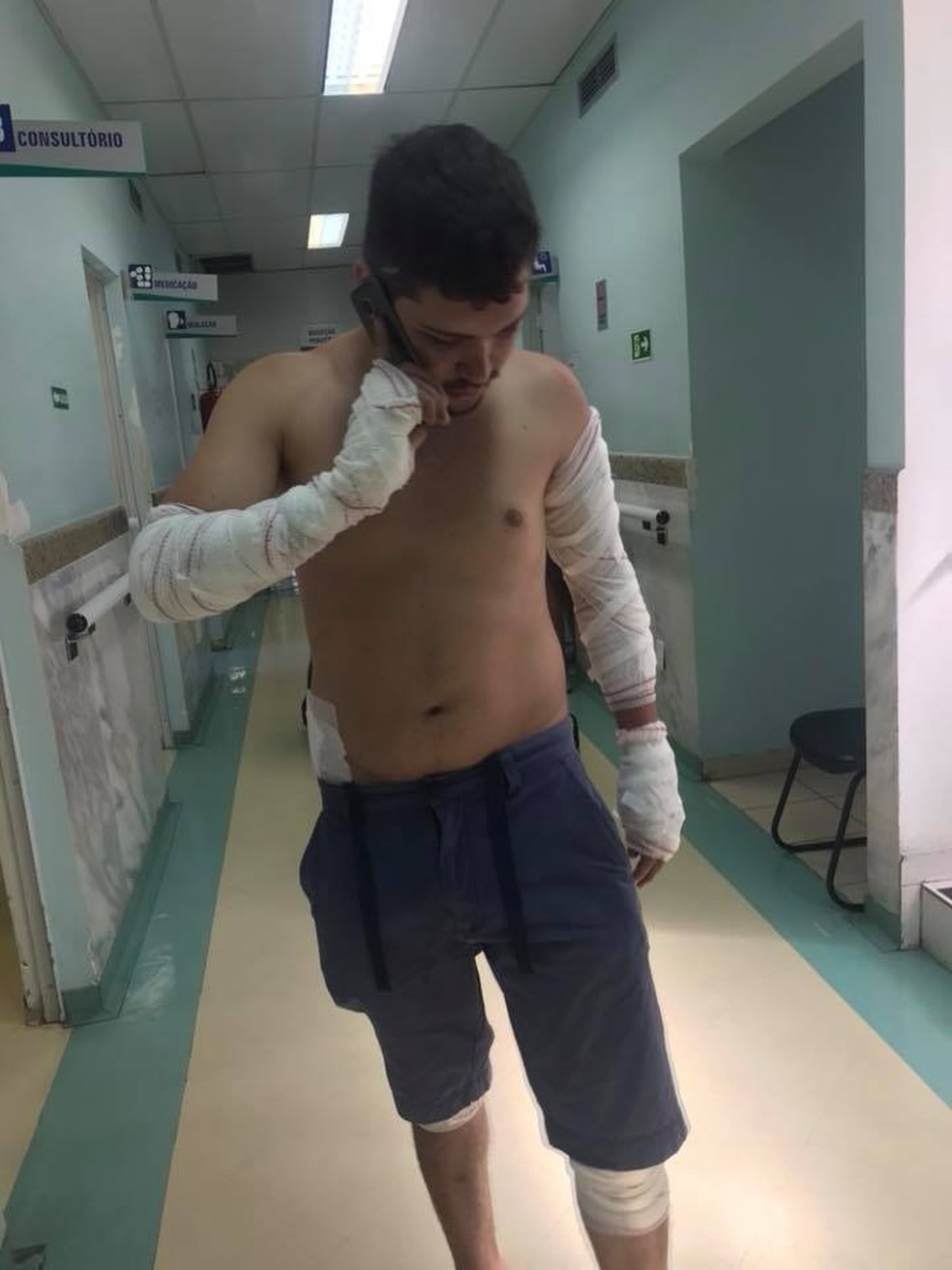 Rafael sofreu ferimentos nos braços e pernas após cair da moto (Foto: Arquivo Pessoal)