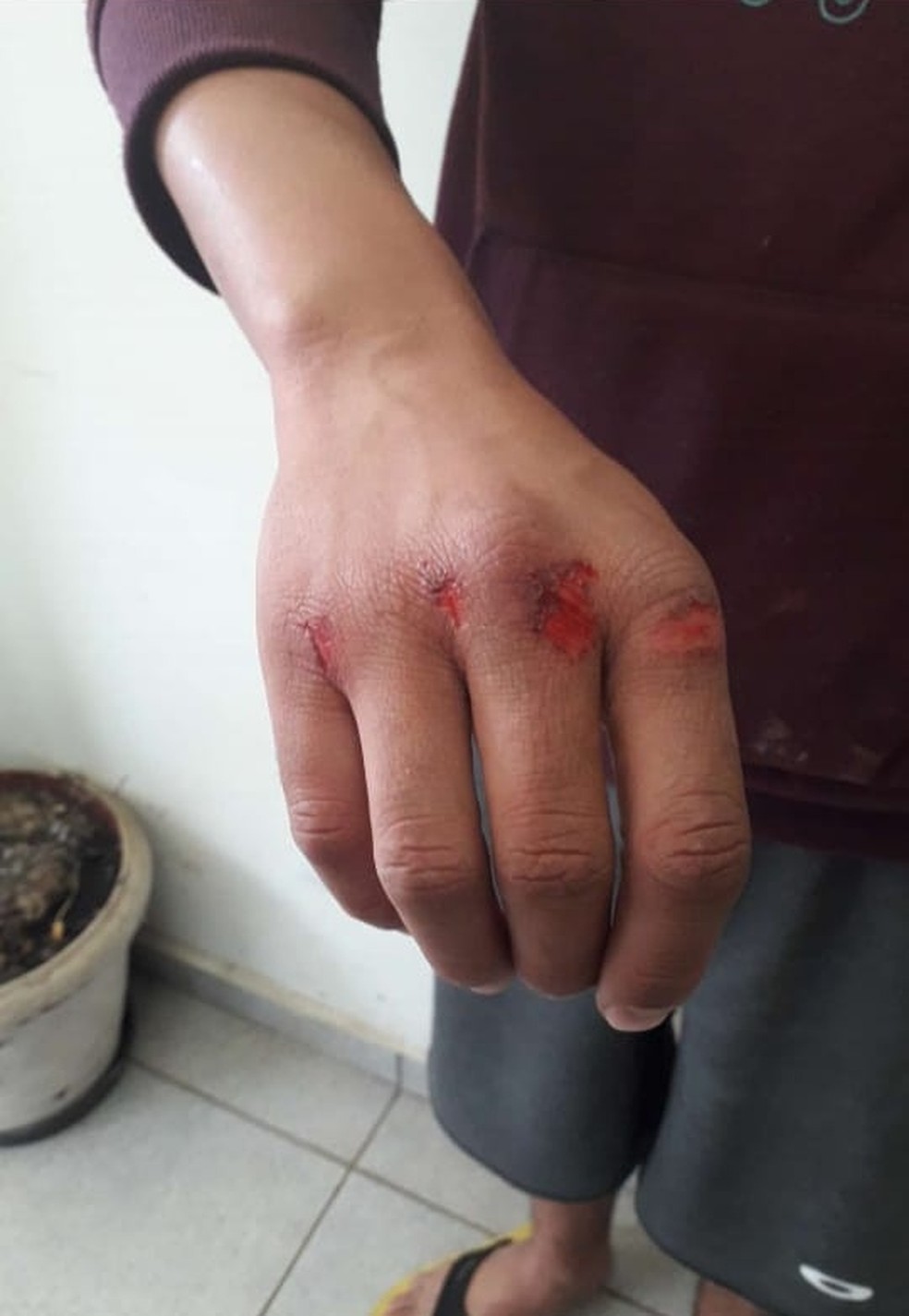 As agressões foram tão fortes que o homem machucou as mãos durante o ato de violência doméstica em Pirajuí (SP) — Foto: Polícia Civil/ Divulgação