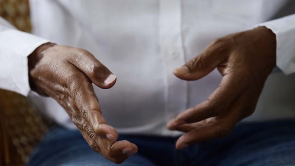 Os médicos levaram 16 horas para reanimar o professor Joseph e costurar de volta a mão decepada — Foto: BBC