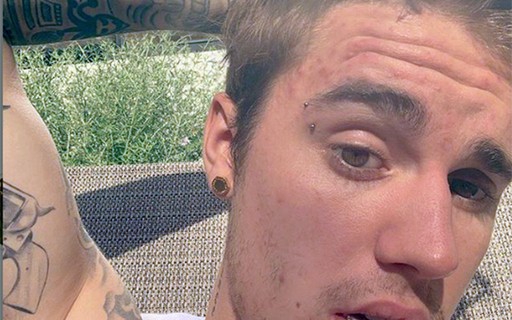 Justin Bieber fez um piercing na sobrancelha