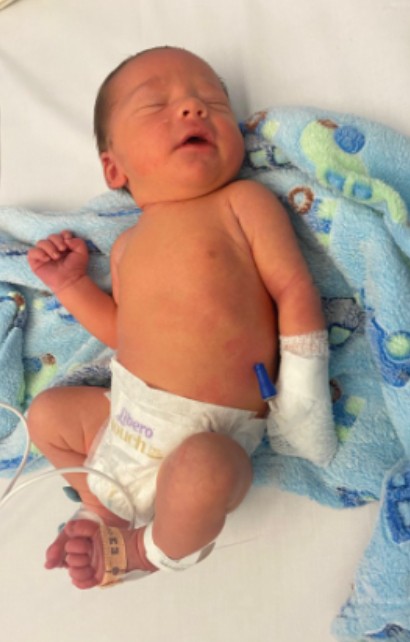 Enfermeiras identificaram caroço no testículo do menino horas depois do parto (Foto: Arquivo pessoal)