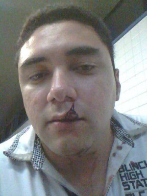 Alex Gomes postou foto em que aparece agredido (Foto: Alex Gomes/Arquivo pessoal)