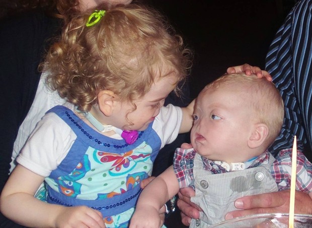 O encontro de Tessa e Eli: os dois nasceram sem nariz (Foto: Reprodução/ Facebook)