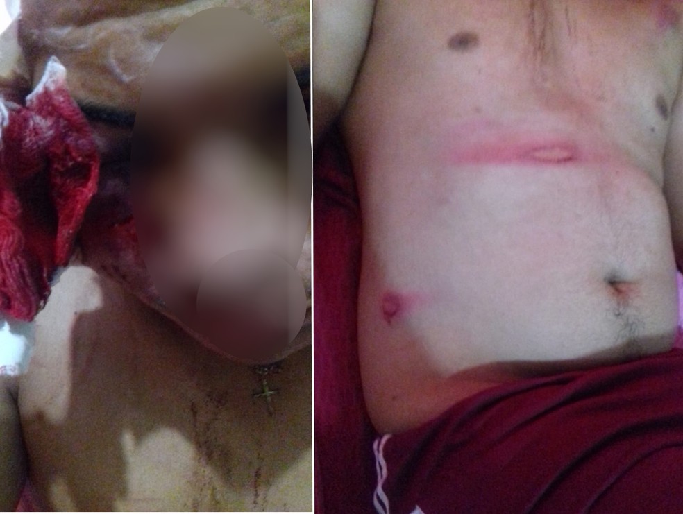Adolescente fica ferido após ser agredido por PMs em Padre Bernardo — Foto: Reprodução/TV Anhanguera