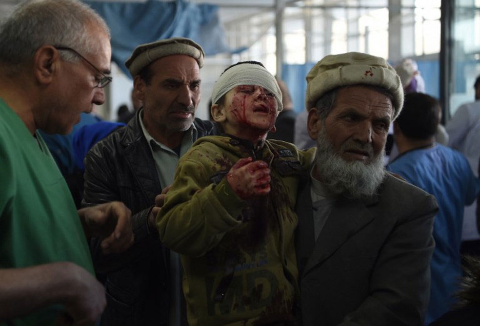 Homem carrega criança atingida por explosão de ‘ambulância-bomba’ em Cabul, no Afeganistão, neste sábado (27)  (Foto: Wakil Kohsar / AFP)