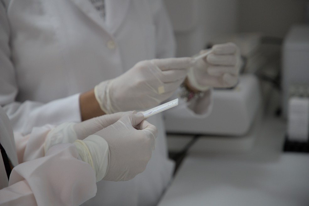Novo teste de sífilis teve depósito de patente internacional e terá solicitação de registro na Anvisa — Foto: Ascom/Lais/UFRN