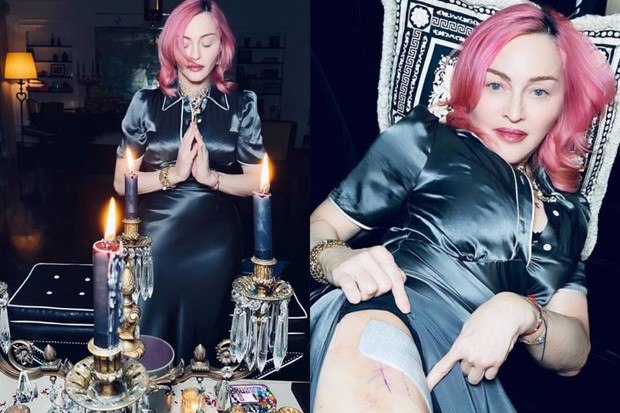 Madonna exibindo corte na perna durante ritual (Foto: Reprodução/ Instagram)