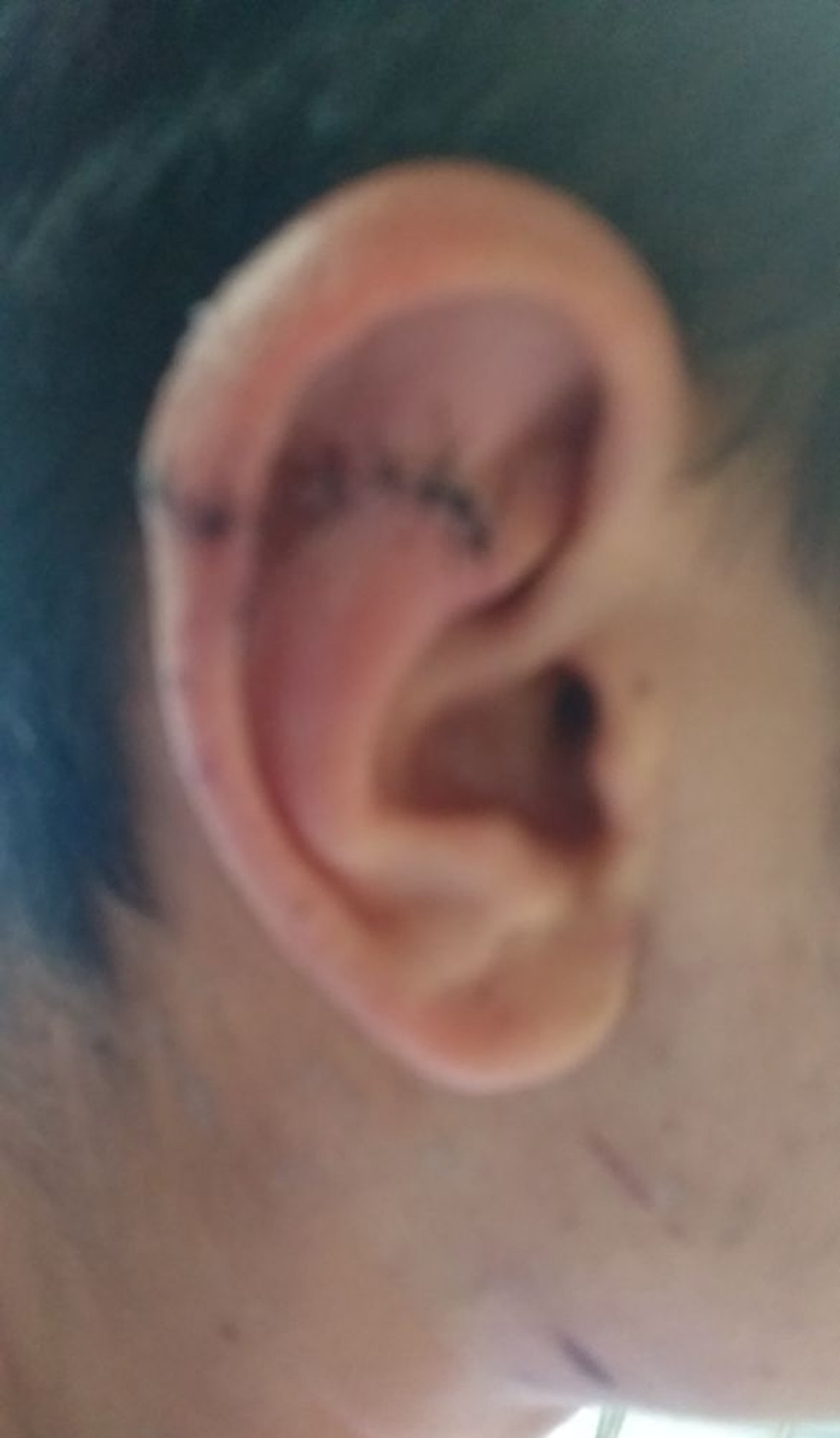 Adolescente foi agredido a coronhadas após briga por cachorros (Foto: G1 MS)