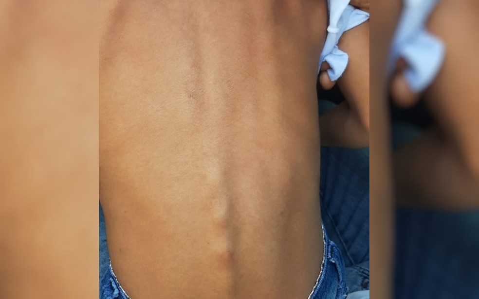 Criança bastante magra que relatou à polícia passar fome porque mãe e padrasto não a alimentavam em Mineiros, Goiás — Foto: Divulgação/Polícia Civil