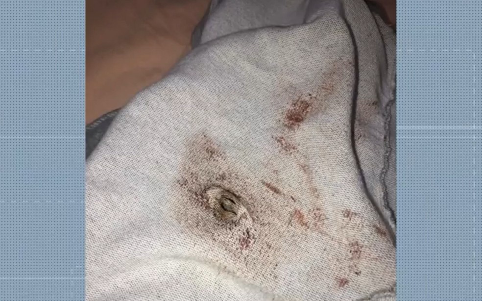 Jovens ficam feridos após agentes da GCM atiraram com bala de borracha durante ação em Salvador — Foto: Reprodução/TV Bahia