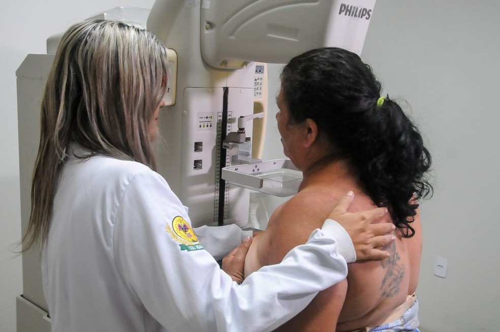 A mamografia é o principal exame de detecção precoce do câncer de mama. — Foto: Marco Antônio/ Secom Maceió