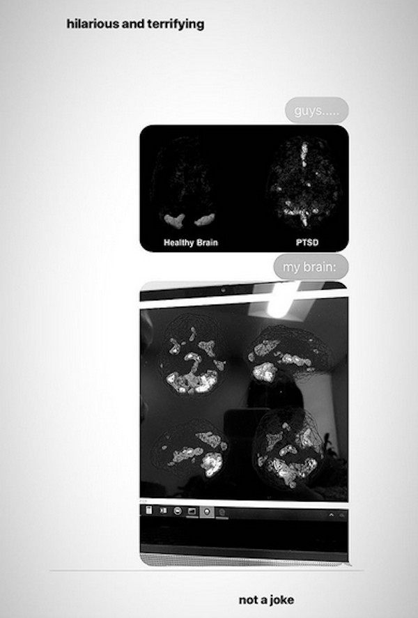 As tomografias compartilhadas pela cantora Ariana Grande (Foto: Instagram)