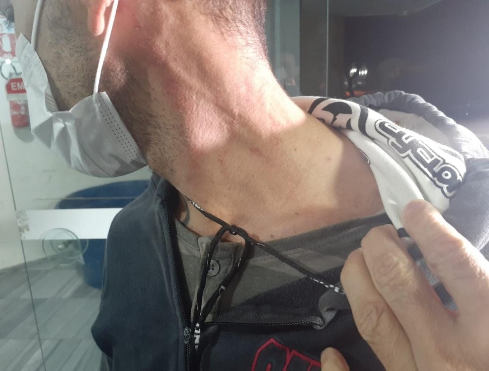 Paciente de UPA disse que foi agredido por médico. Profissional disse que tentou conter homem, que estaria agressivo. — Foto: Sérgio Henrique Santos/Inter TV Cabugi