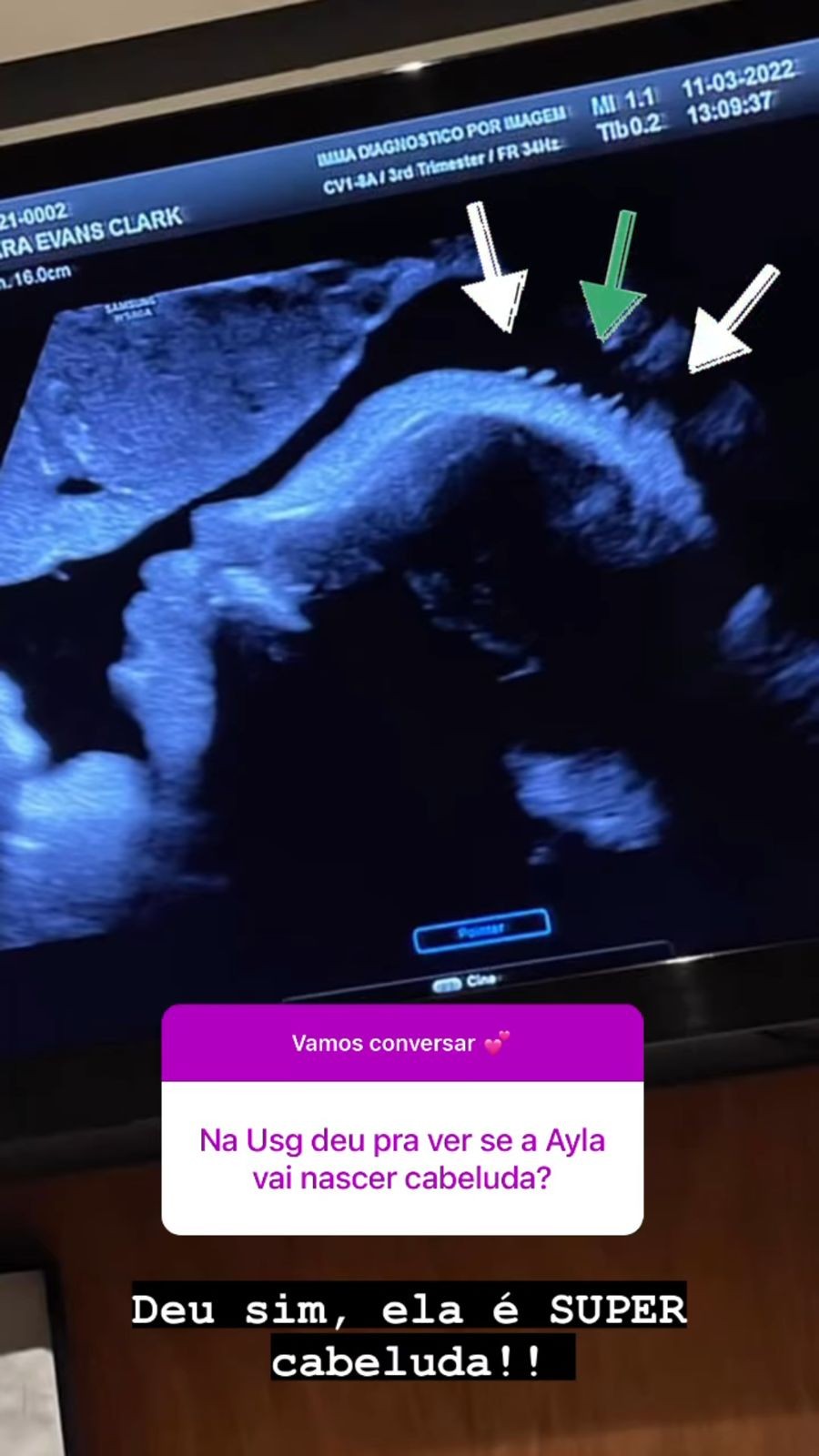 Bárbara Evans mostra rostinho da filha em ultrassom  (Foto: instagram/reprodução)