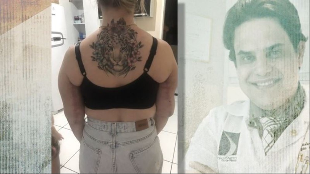 Jeordana se submeteu ainda a uma cirurgia para a retirada de gordura dos braços: 'Eu não uso mais blusa de manga ou de alça' — Foto: Reprodução